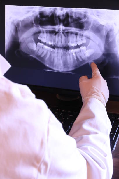 Best Emergency Dental Extractions in Junction City, OR